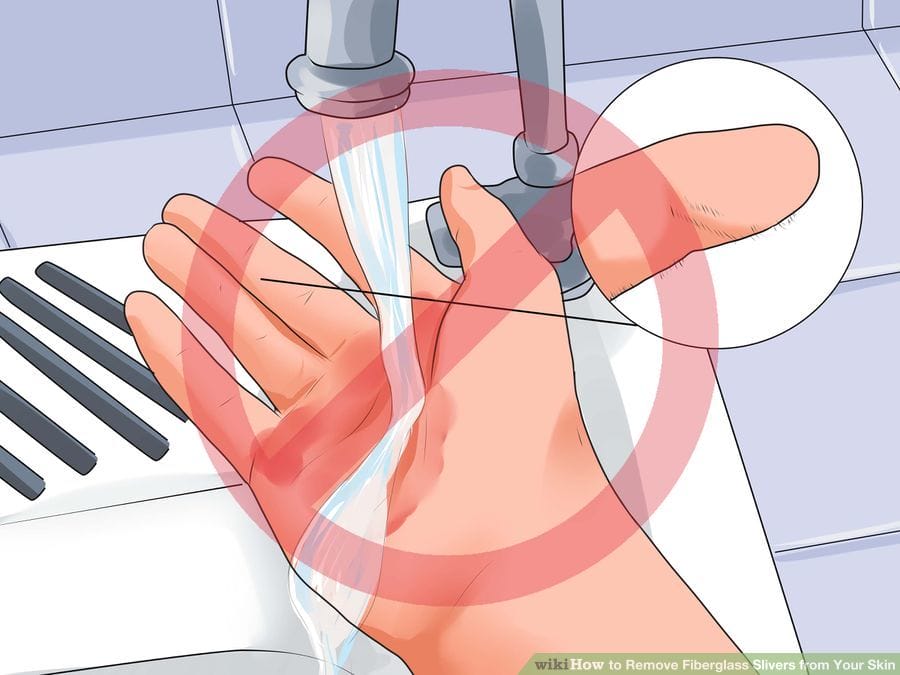 Không nên rửa tay khi tiếp xúc bông thủy tinh